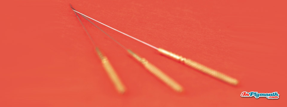 What Are the Benefits of Acupuncture?